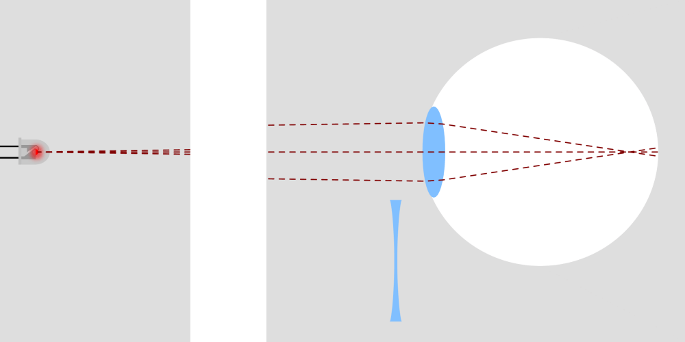 Correction of Near-sightedness & Far-sightedness