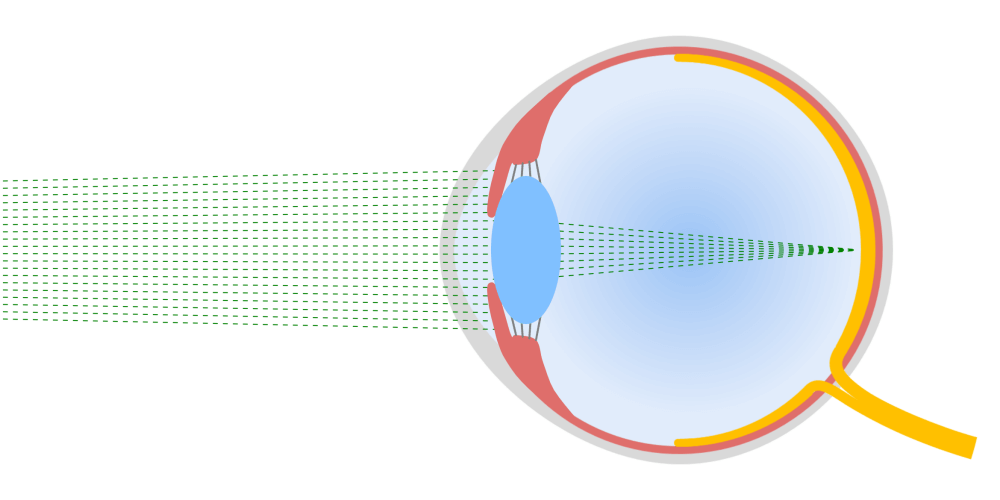 Iris and ciliary body