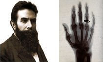 Roentgen